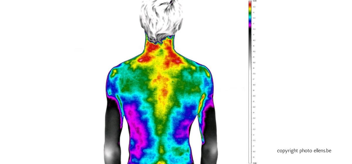 thermographie